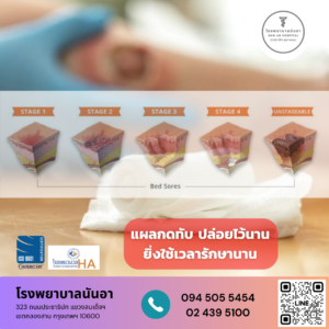 รักษาแผลกดทับ ผู้ป่วยติดเตียง